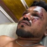 Ahmedabad Plane Crash: Vishwas Kumar Ramesh Only Survivor of AI 171 Tragedy