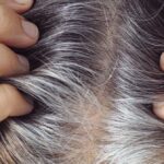 Grey Hair Before 35 May Signal More Than Premature Ageing, Dermatologist Explains